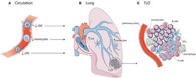 Dendritic Cell Subsets and Effector Function in Idiopathic and Connective Tissue Disease-Associated Pulmonary Arterial Hypertension